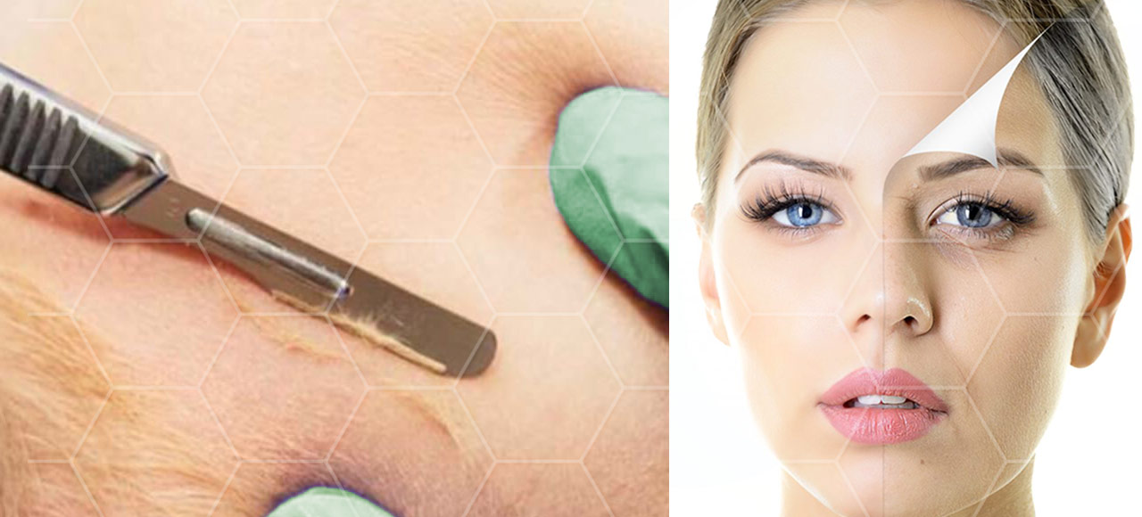 Beauty Elements - Dermaplaning & Oilplaning